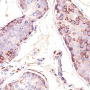 Formalin-fixed, paraffin embedded human testis sections stained with 100 ul anti-MAGE-1 (clone SPM282) at 1:100. HIER epitope retrieval prior to staining was performed in 10mM Citrate, pH 6.0.